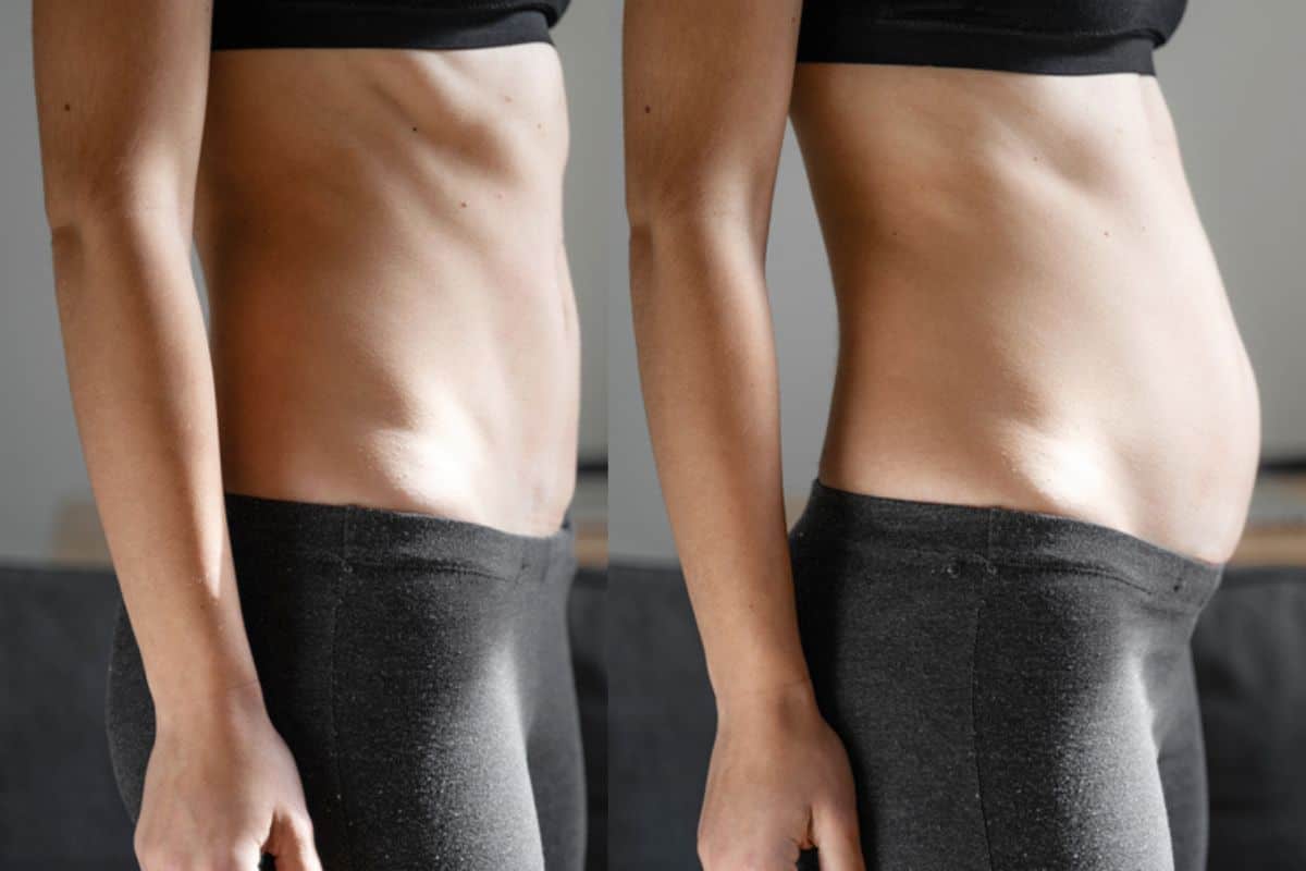 How long does diastasis recti take to improve Poole?