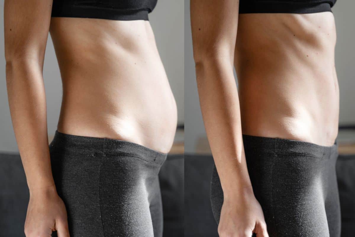 Post-Pregnancy: What Happens to Your Abdominal Muscles After Birth Poole