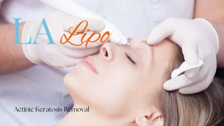Woman receiving Actinic Keratosis Removal Treatment Poole