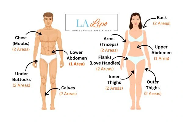 LA LIPO Cryolipolysis Areas Poole