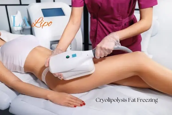 Woman receiving coolsculpting Poole treatment on her thighs