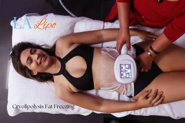 woman getting cryolipolysis Poole