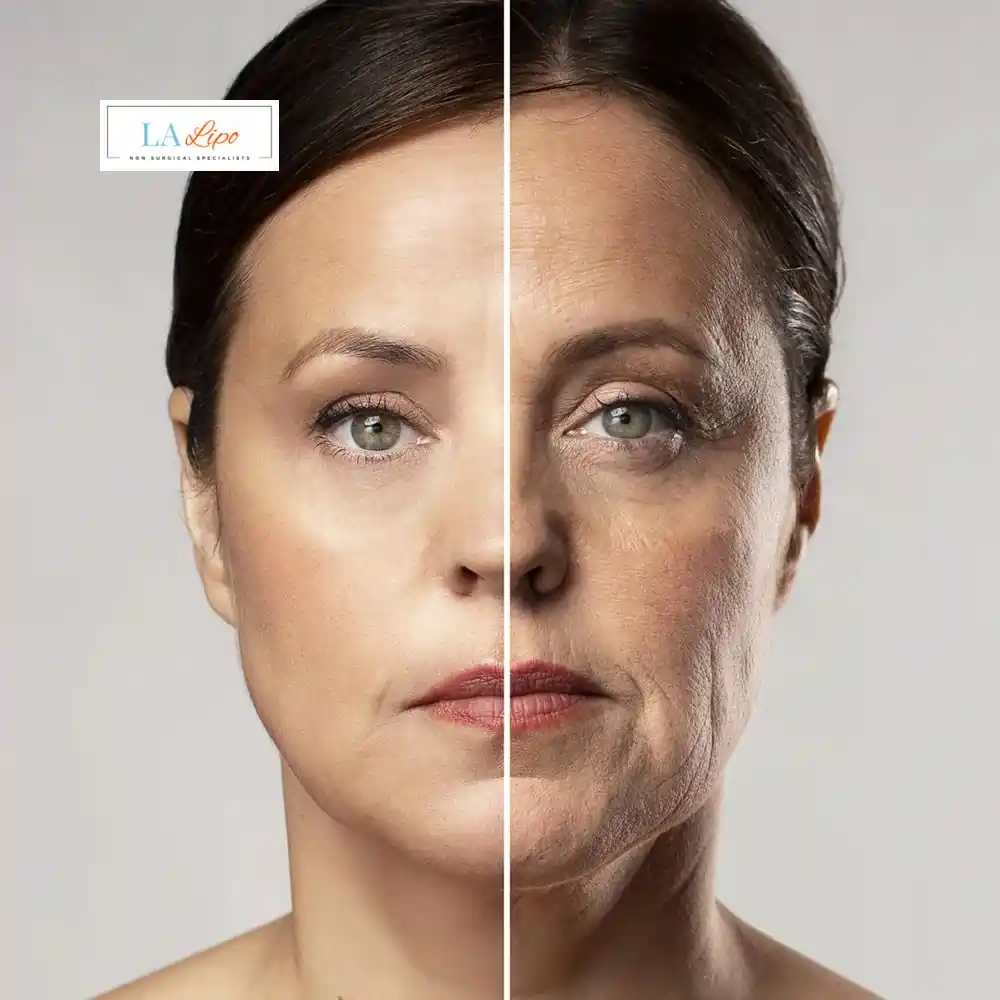 How Can You Tell If Non-Surgical Skin Tightening Is Right for You Poole?