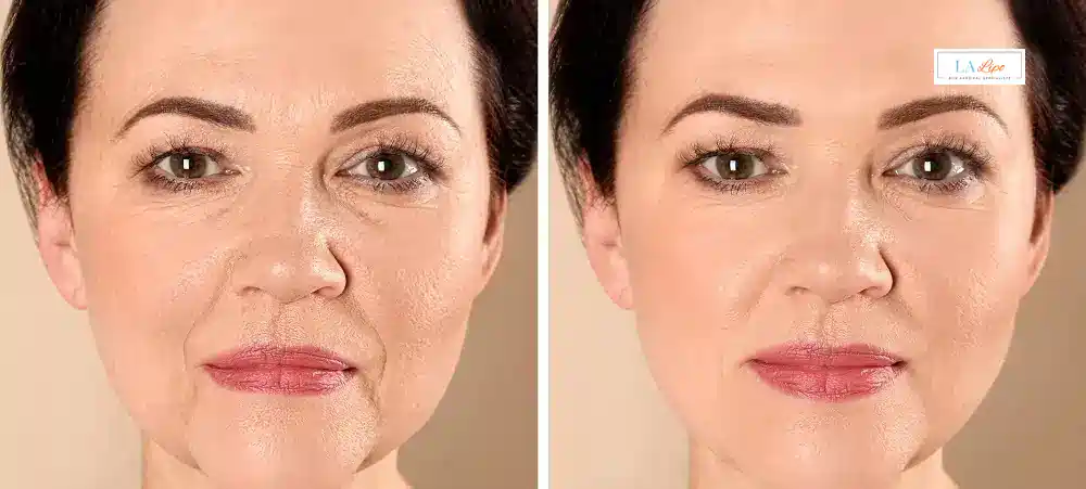 How Long Does It Take to See Results and How Long Do They Last Poole?