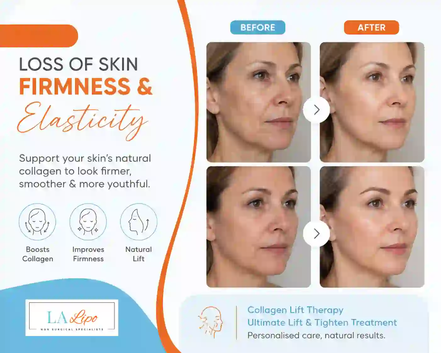 Sign #7: Loss of Skin Firmness and Elasticity Poole